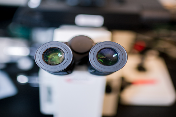 A microscope eyepiece used in a rheumatology research lab