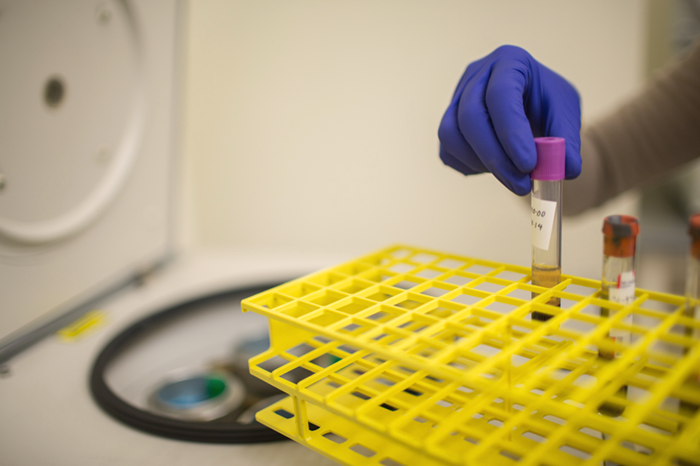 A rheumatology investigator handling vials in lab, working towards RA cures.